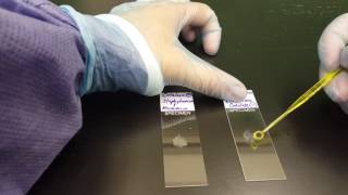 Microbiology the Catalase test [upl. by Akym]