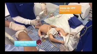 REANIMACION NEONATAL ALGORITMO COMPLETO [upl. by Beitch]