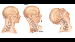 ESGUINCE CERVICAL SÍNTOMAS  GRADOS DE ESGUINCE CERVICAL  TRATAMIENTO PARA ESGUINCE CERVICAL [upl. by Ayrb]