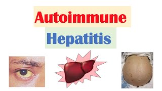 Hepatitis B Lab diagnosis within 5 minutes [upl. by Nov408]