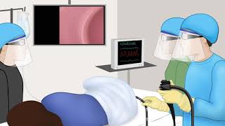 Endoscopy Technology TheoryLesson 3Endoscope Structure [upl. by Ilatan]