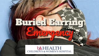 Buried Earring Emergency [upl. by Crandale]