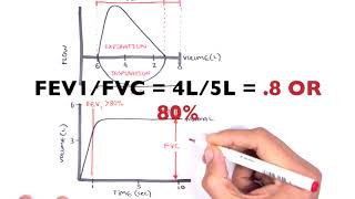 Understanding Spirometry  Normal Obstructive vs Restrictive [upl. by Adah]