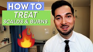 Burns  How To Treat Burns  How To Treat A Burn [upl. by Shiroma596]