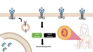 Clinical usage of antibody Herceptin Antibody as breast cancer medicine [upl. by Mohl]