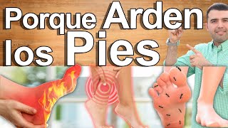 Porqué Me Arden Los Pies  Causas Y Soluciones Para El Ardor Y Dolor En Los Pies [upl. by Thgiwed]