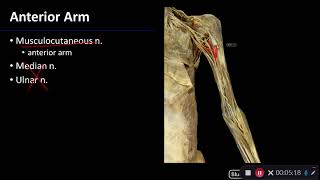 Nerves Overview of Upper Limb  Dissection Supplement [upl. by Rehtae]