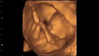 Baby 18 Schwangerschaftswoche Ultraschall  18SSW  18th week of pregnancy ultrasound [upl. by Jennee]