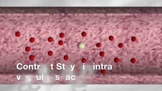 TMT CONTRAST ENHANCED ULTRASOUND CEUS BASICS [upl. by Bernetta]