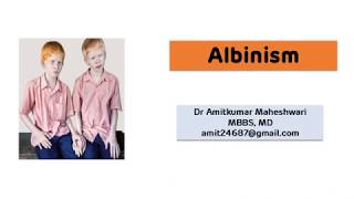 Albinism  Deficiency of Tyrosinase [upl. by Bernardo775]