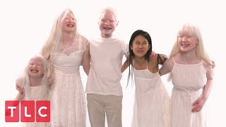 The Grabowskis Unique Adoption Story Part 2  Born With Albinism [upl. by Eeleak]