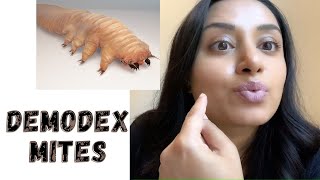 Demodex Mites on the FACE [upl. by Alleb]