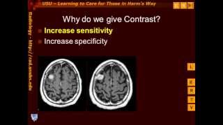 Introduction to Contrast Enhancement [upl. by Aeiram580]