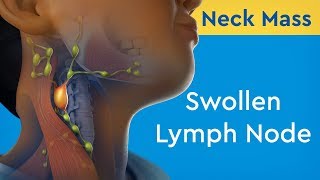 OMT Lymphatic  Cervical Lymphatic Chain Drainage [upl. by Preuss]