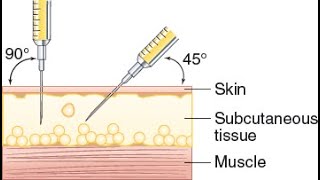 Subcutaneous Injection Demonstration [upl. by Nirol348]