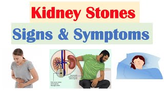 Imaging Evaluation and Treatment of Nephrolithiasis at Mayo Clinic [upl. by Yekciv483]