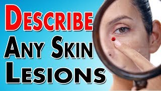 Describing Skin Lesions [upl. by Marcia]