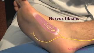 Motorische Neurographie  Tibialis [upl. by Aymik775]