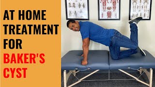 4 Self Treatments For Baker’s Cysts In The Knee [upl. by Pietro316]