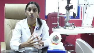 Iritis  What is Anterior Uveitis Doctor Explains [upl. by Enawtna]