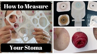 How to Measure Your Stoma OSTOMY TIPS [upl. by Rosmunda]