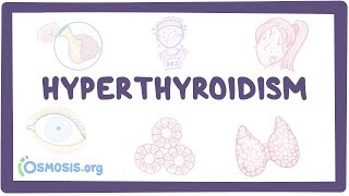 How to Get Your Thyroid to Work Correctly [upl. by Merlina]