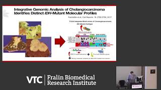 Current Approaches to Treating Cholangiocarcinoma [upl. by Rad]