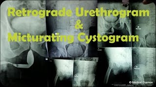 Radiographic Contrast Studies of the Urinary System [upl. by Clorinde803]