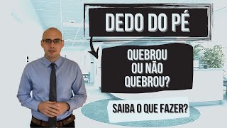 DEDO DO PÉ QUEBROU OU ACHA QUE QUEBROU ASSISTA [upl. by Aydidey]