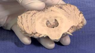 The Cerebellum Neuroanatomy Video Lab  Brain Dissections [upl. by Ledif]