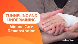 Tunneling and Undermining  Wound Care Demonstration [upl. by Annirak]