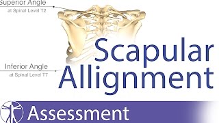 Scapular Alignment and possible causes for dyskinesia [upl. by Nnaeel643]