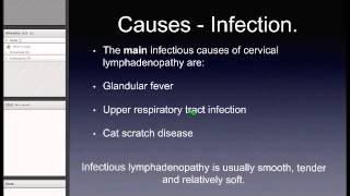 Cervical Lymphadenopathy [upl. by Esertap]