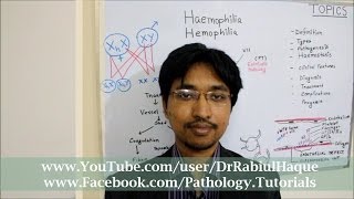 Hemophilia Types  hemophilia A Hemophilia B and Hemophilia C  Comparison  Genetics Hematology [upl. by Aramac]