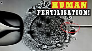 Human Sperm and Egg Fertilization Microscope  IVF ICSI Procedure [upl. by Manvil827]