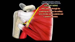 NERVE INJURY IN THE UPPER EXTREMITY Everything You Need To Know  Dr Nabil Ebraheim [upl. by Follansbee]