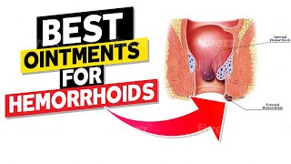 Best Ointments for Hemorrhoids [upl. by Llerrod]