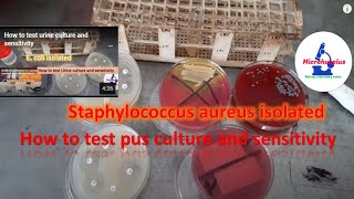 How to test pus culture and sensitivity [upl. by Nitsua]