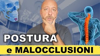 MALOCCLUSIONI E POSTURA [upl. by Constantin]