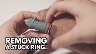 Quick tip How to remove a stuck ring [upl. by Kannry]