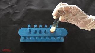 Saponin Foam Test  Saponin Identification Test  Phytochemical Test for Saponin  ENGLISH [upl. by Stockmon409]