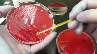 Microbiology Bacteroides fragilis biochemical testing and colonial growth [upl. by Artemla584]