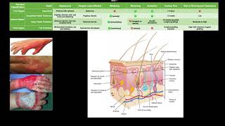 Classifying Burns EXPLAINED [upl. by Greer]