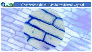 REO 8  Vídeo 82  Visualização de células da epiderme vegetal [upl. by Selrahc119]