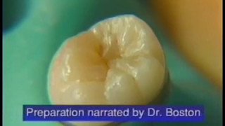 Fissurotomy®  How to Perform Minimally Invasive Fissure Exploration [upl. by Enailil]