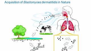 Dimorphic Fungi Blastomycosis Hot Topic [upl. by Old881]