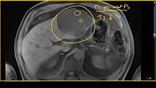 Liver disease Symptoms in adults 5 Signs your liver is damaged  Dr Ravindra B S  Doctors Circle [upl. by Horatio]