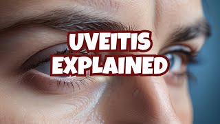 Uveitis [upl. by Ragucci413]