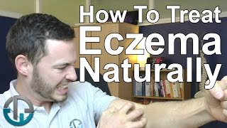 How To Treat Eczema Naturally [upl. by Anaynek]