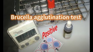 Brucella rapid agglutination test [upl. by Aitsirk]